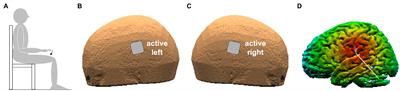 Dual-Hemisphere Transcranial Direct Current Stimulation on Parietal Operculum Does Not Affect the Programming of Intra-limb Anticipatory Postural Adjustments